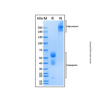 Recombinant Human Haptoglobin Protein,无动物源, 无载体, 生物活性, ActiBioPure™, His标签, PBS Only, ≥95%(SDS-PAGE), 见COA,阿拉丁