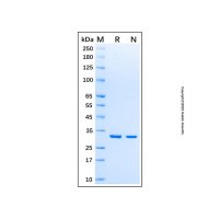 Recombinant Human Annexin V/ANXA5 Protein,Carrier Free, ≥95%(SDS-PAGE),阿拉丁