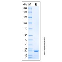 Recombinant Human CRYGN Protein,无载体, His标签, ≥90%(SDS-PAGE), expressed in E. coli; 见COA,阿拉丁