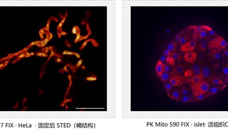 PK Mito 590 FIX / PK Mito 647 FIX新一代可固定（Fixable）线粒体内膜荧光探针 —— 10 分钟活染，固定后信号保留高至 94%，打通活细胞动态成像到固定后超分辨结构成像链路