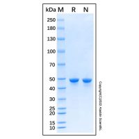 Recombinant Human Carboxypeptidase A4/CPA4 Protein,无动物源,无载体,His标签,≥90%(SDS-PAGE),见COA,阿拉丁