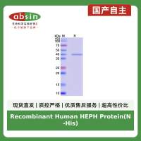 Recombinant Human HEPH Protein(N-His)