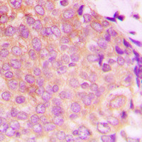 Rabbit anti-HSP60 Polyclonal Antibody
