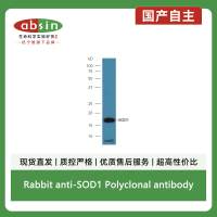 Rabbit anti-SOD1 Polyclonal antibody