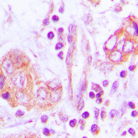 Rabbit anti-OTUB2 Polyclonal Antibody