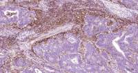 Rabbit anti-ICAM1 Polyclonal Antibody