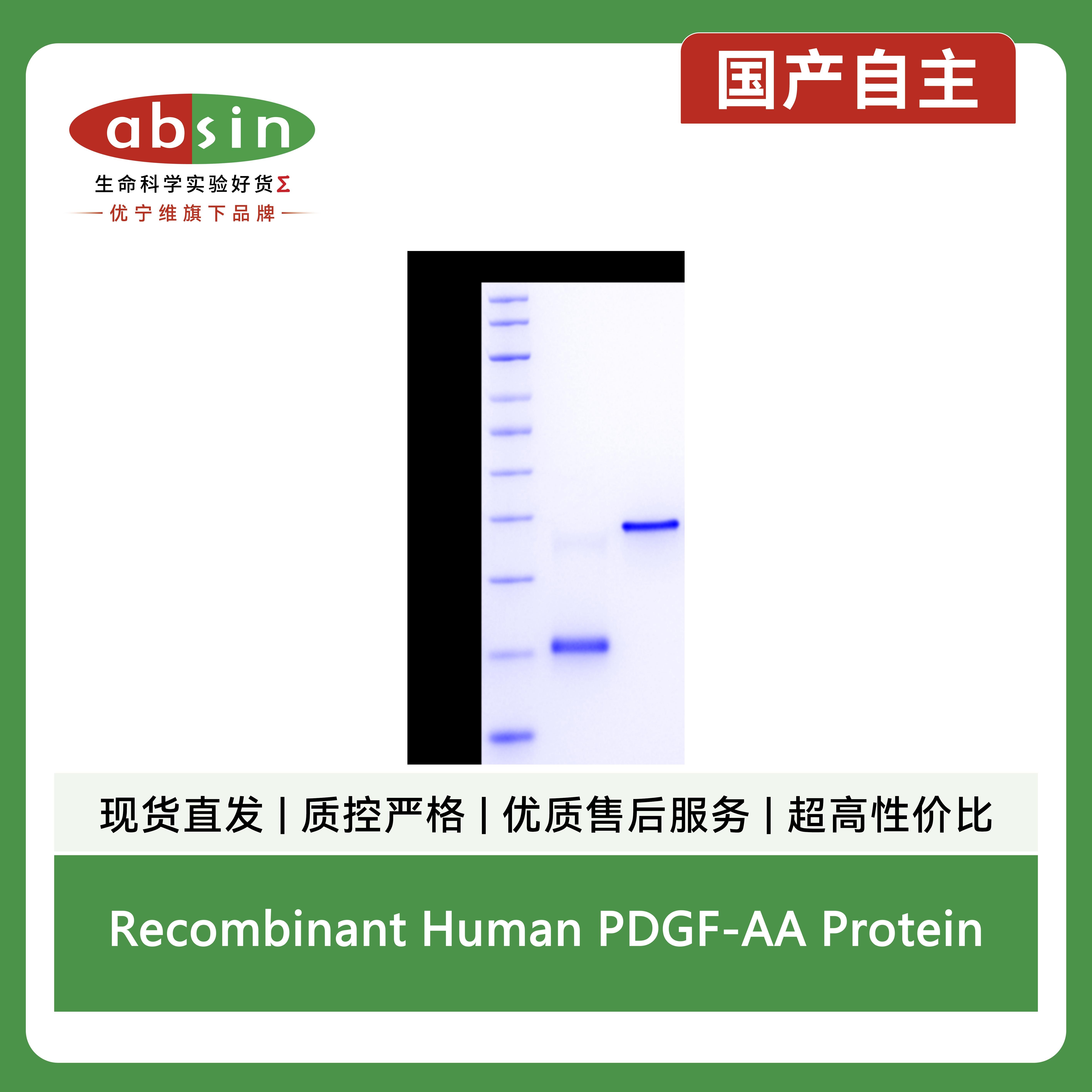 Recombinant Human PDGF-AA Protein产品图