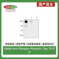 Rabbit anti-Phospho-Phospho- Zap-70 (Tyr319)/Syk (Tyr352) Monoclonal Antibody(S-1252-12)