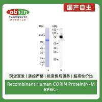 Recombinant Human CORIN Protein(N-MBP&C-His)