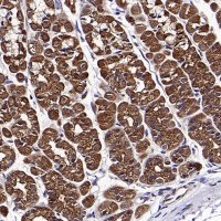 Rabbit anti-Acetyl-CoA Carboxylase Recombinant Monoclonal Antibody(S-2220-96)