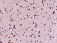 Rabbit anti-GDNF Polyclonal Antibody