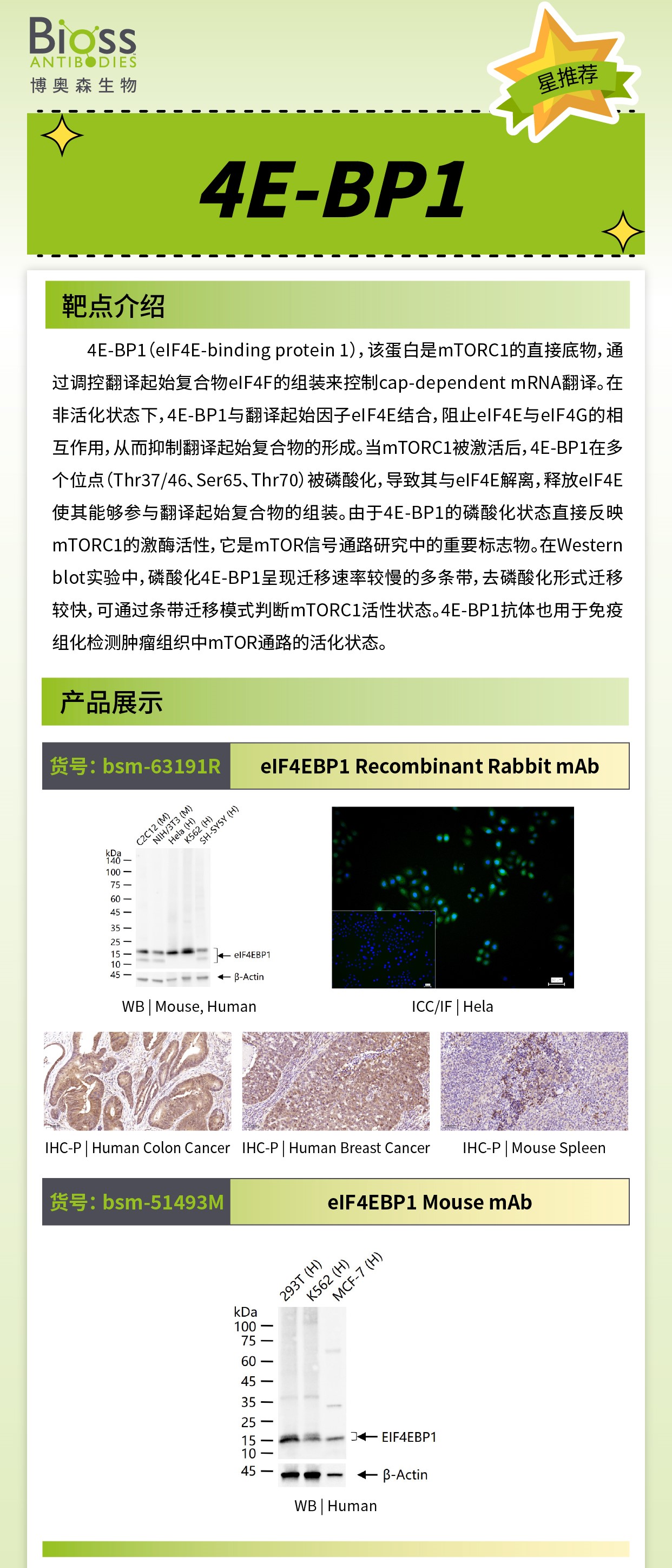 博奥森星推荐 | 4E-BP1 抗体