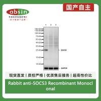 Rabbit anti-SOCS3 Recombinant Monoclonal Antibody(S-2238-34)