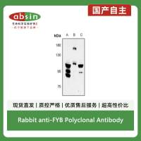 Rabbit anti-FYB Polyclonal Antibody
