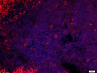Rabbit Anti-Stabilin 2/STAB 2 Polyclonal Antibody