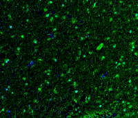 Goat anti-S100B Polyclonal Antibody