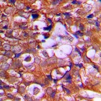 Rabbit anti-PTEN Polyclonal Antibody