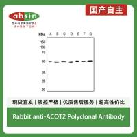 Rabbit anti-ACOT2 Polyclonal Antibody