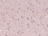 Rabbit Anti-PDZD8 Polyclonal Antibody