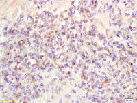 VEGFR3 Polyclonal Antibody