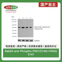 Rabbit anti-Phospho-PAK1(S144)+PAK2(S141)+PAK3(S139) Monoclonal Antibody