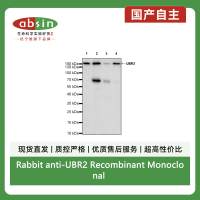Rabbit anti-UBR2 Recombinant Monoclonal Antibody(S-2041-163)