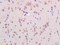 Rabbit anti-RNF123 Polyclonal Antibody
