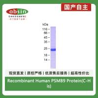 Recombinant Human PSMB9 Protein(C-His)