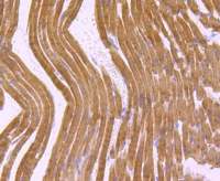 Rabbit anti-MYH6 Recombinant Monoclonal Antibody