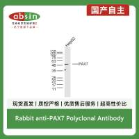 Rabbit anti-PAX7 Polyclonal Antibody