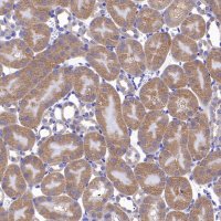 Rabbit anti-PRDM1/Blimp1 Recombinant Monoclonal Antibody(S-1972-3)