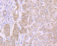Rabbit anti-IL13RA1 Recombinant Monoclonal Antibody