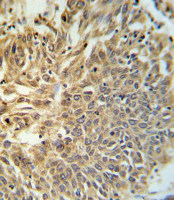 Rabbit anti-HIF1A Polyclonal Antibody