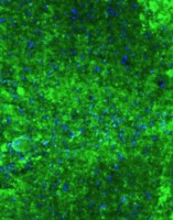 Goat anti-VAChT Polyclonal Antibody