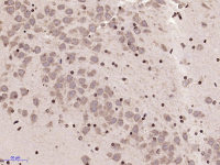 Rabbit anti-MARCH7 Polyclonal Antibody
