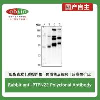 Rabbit anti-PTPN22 Polyclonal Antibody