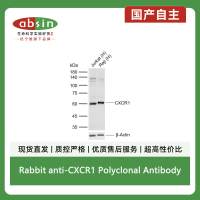 Rabbit anti-CXCR1 Polyclonal Antibody