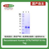 Recombinant Human GITR/TNFRSF18 His Tag Protein(His Tag)