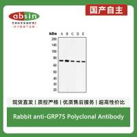 Rabbit anti-GRP75 Polyclonal Antibody