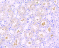 Rabbit anti-SPHK1 Recombinant Monoclonal Antibody