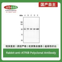 Rabbit anti-ATF6B Polyclonal Antibody