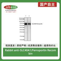 Rabbit anti-SLC40A1/Ferroportin Recombinant Monoclonal Antibody(S-2172-35)