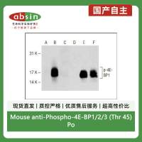 Mouse anti-Phospho-4E-BP1/2/3 (Thr 45)Polyclonal Antibody