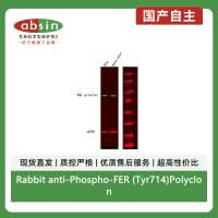 Rabbit anti-Phospho-FER (Tyr714)Polyclonal Antibody