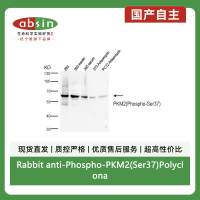Rabbit anti-Phospho-PKM2(Ser37)Polyclonal Antibody