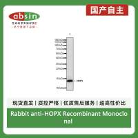Rabbit anti-HOPX Recombinant Monoclonal Antibody(S-2087-269)