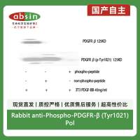 Rabbit anti-Phospho-PDGFR-β (Tyr1021)Polyclonal Antibody