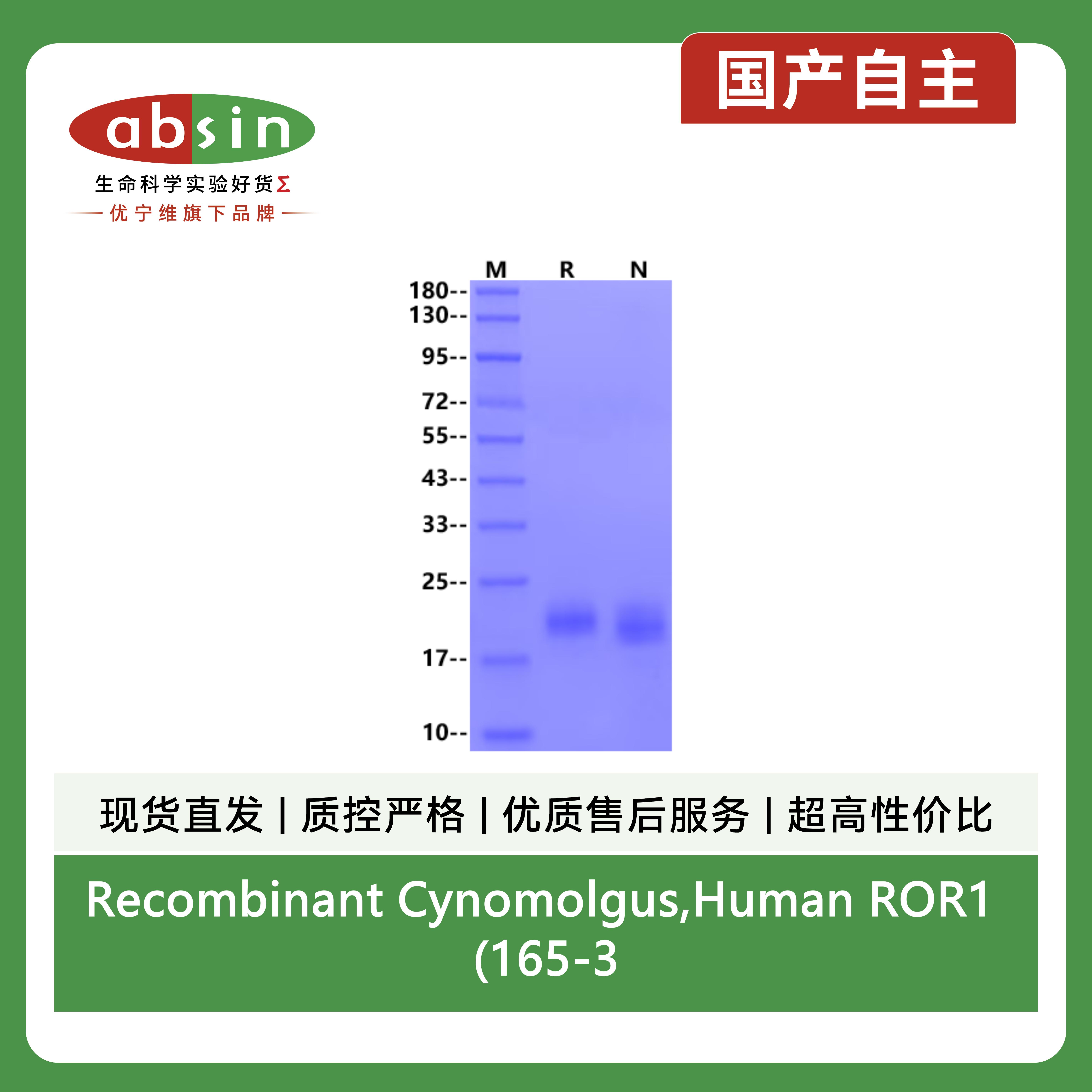Recombinant Cynomolgus,Human ROR1 (165-305, Frizzled Domain) His Tag Protein(His Tag)产品图