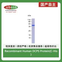 Recombinant Human DCPS Protein(C-His)