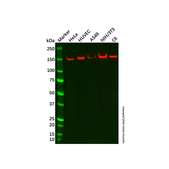 Recombinant DAP Kinase 1 Antibody，ExactAb™, Validated, 重组, 1.5 mg/mL，阿拉丁产品图